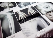 Juchuuu Rentgen lidského těla